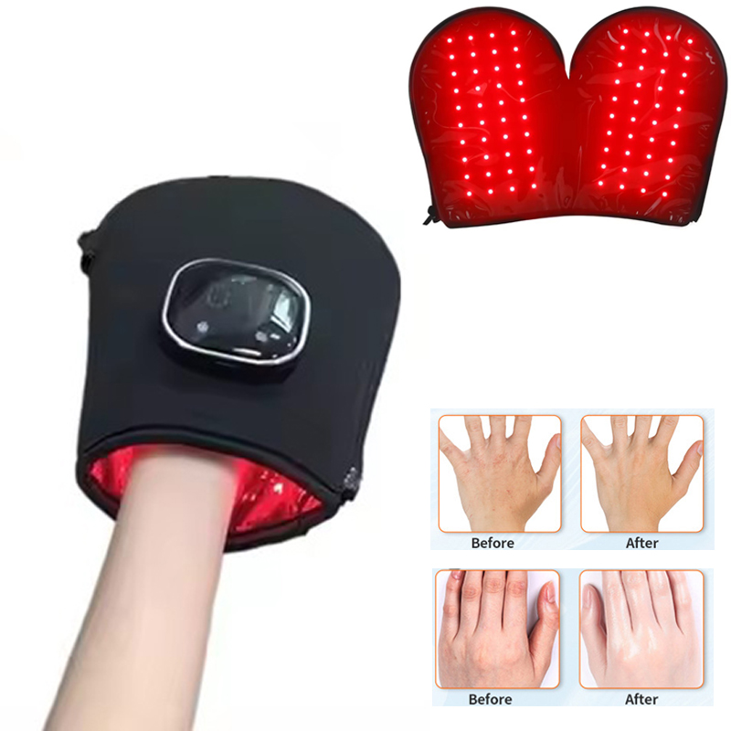 Galvanic Skin Sensor - Perangkat Terapi Cahaya Merah Baru untuk
