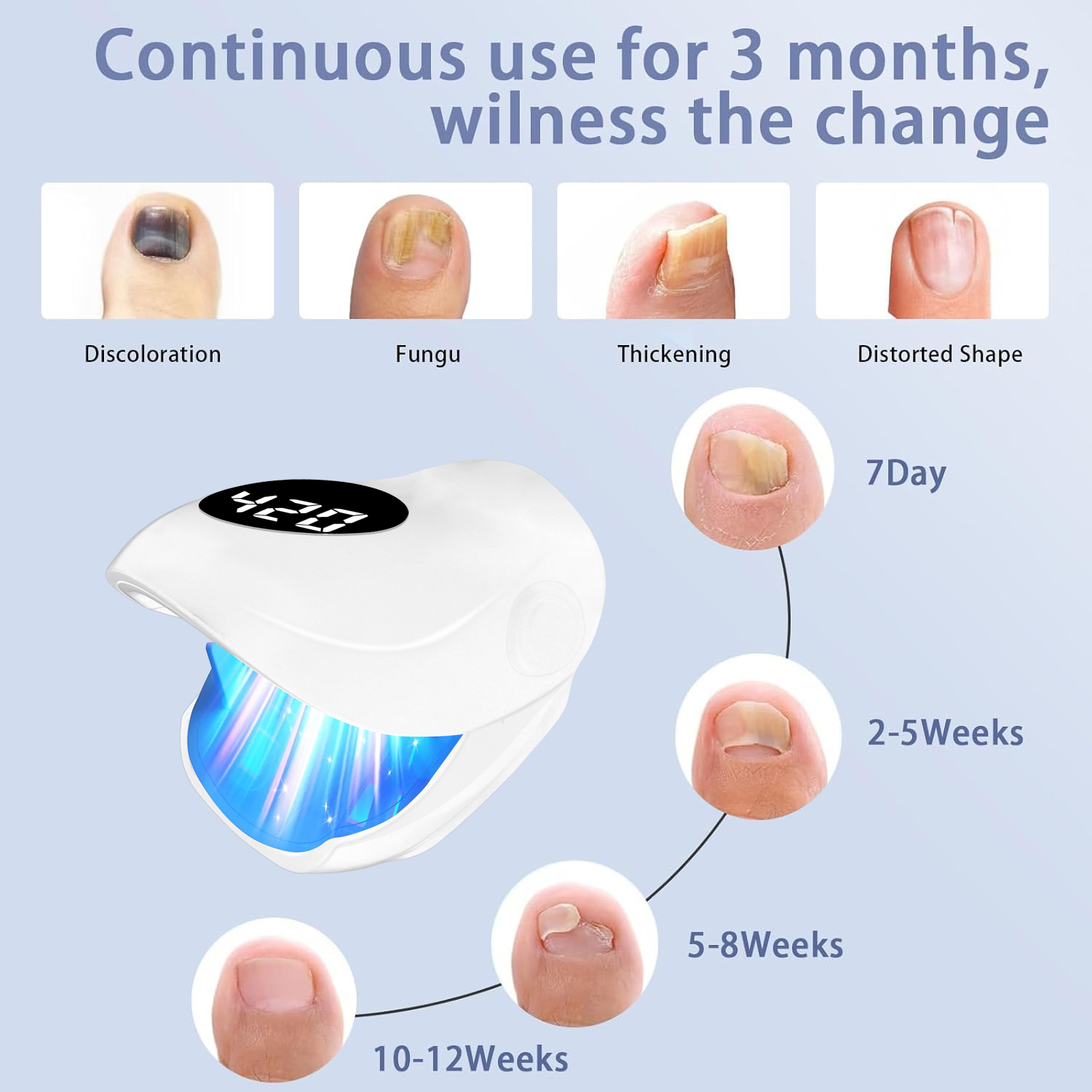 Perangkat Perawatan Jamur Kuku - Galvanic Skin Sensor ulasan dan harga